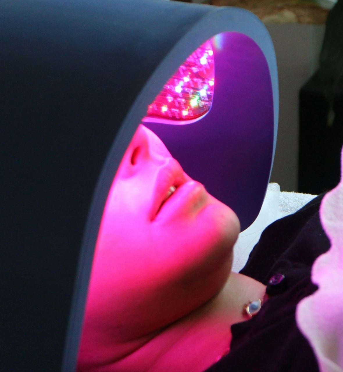 Beneficios de la Red Light Therapy en la mujer